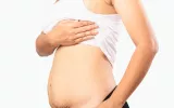 Tummy Tuck After Pregnancy for a Confident You